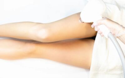 Top 5 razones para elegir la depilación láser