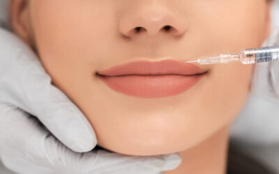 Aumento de labios: Guía sobre perfilado y relleno de labios