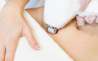 La depilación íntima femenina