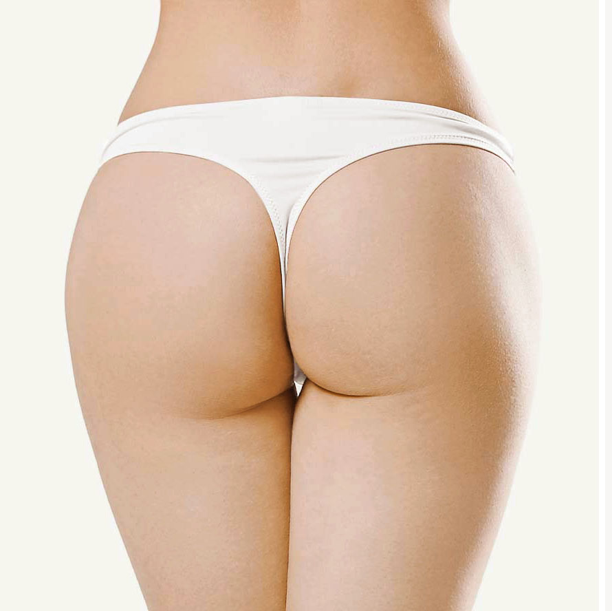 intergluteo mujer