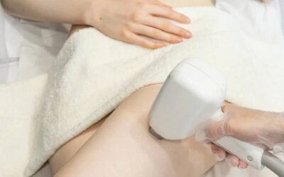 ¿Por qué elegir láser de diodo para la depilación íntima femenina?