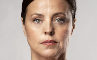 Tratamiento antiarrugas: Todo lo que debes saber