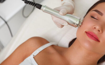 Radiofrecuencia: Qué es, antes y después y opiniones