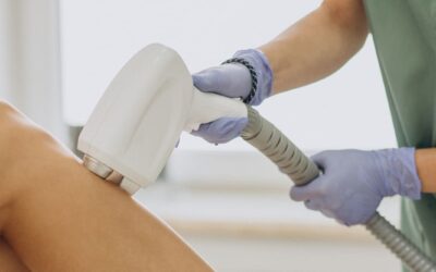 Precio de la depilación láser