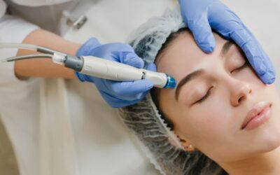 Precio de la radiofrecuencia