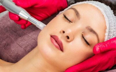 Precio de la mesoterapia facial
