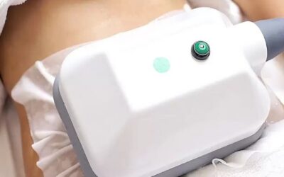 Precio de la criolipólisis