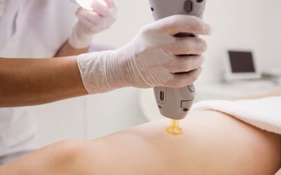 Tipos de depilación láser