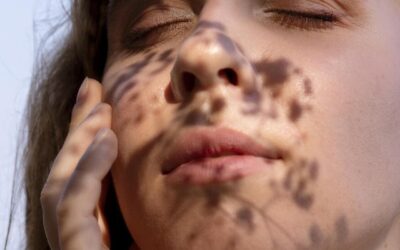 Tratamientos para las manchas de la cara