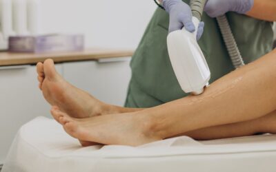 ¿Es posible conseguir una depilación láser barata y de calidad?