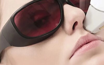 9 curiosidades sobre la depilación láser facial