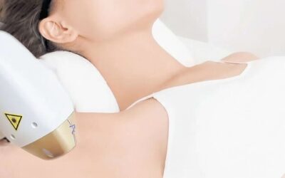 Cómo funciona la depilación láser de diodo