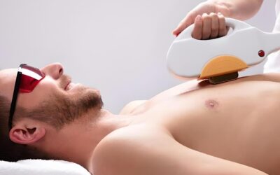 Métodos de depilación masculina: ¿Cuál es mejor?