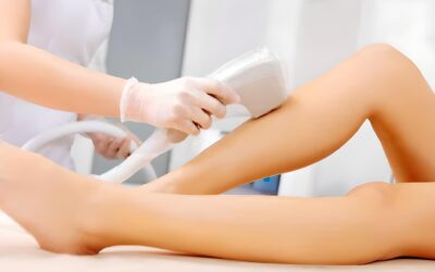 ¿A qué edad se recomienda comenzar con la depilación láser?