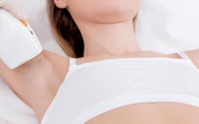 Depilación láser en axilas: Todo lo que necesitas saber