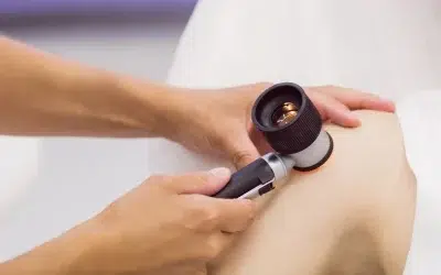 Cómo acelerar recuperación piel después de depilación láser