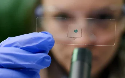 Cómo la genética influye en los resultados de la depilación láser