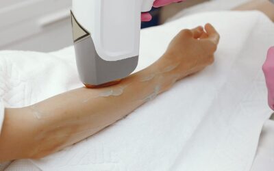 ¿La depilación láser afecta el grosor de la epidermis?