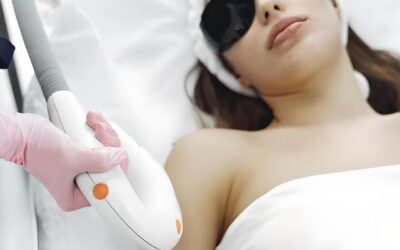 ¿Granos en la tripa después de la depilación láser? Descubre cómo evitarlos